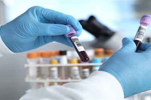 Simple blood test can predict the patients most likely to die from Covid