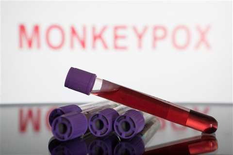 What You Need to Know About Monkeypox