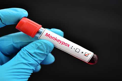 Federal officials declare a public health emergency for monkeypox ⋆