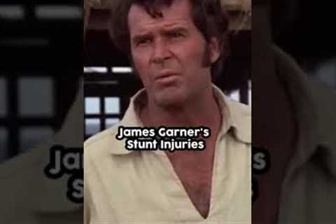 James Garner''s Stunt Injuries #shorts #jamesgarner