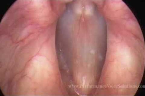 Video Stroboscopy of Vocal Cords