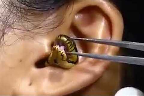 ‘Surgeon’ struggles to remove live snake from woman’s ear in viral video