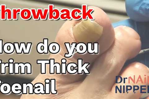 Dr Nail Nipper's audio video - How do you Trim Thick Toenails. Throwback