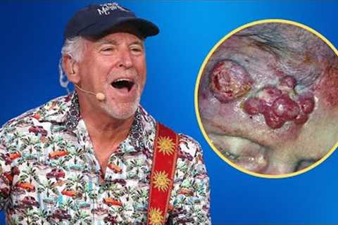 The Rare and Shocking Disease That Killed Jimmy Buffett