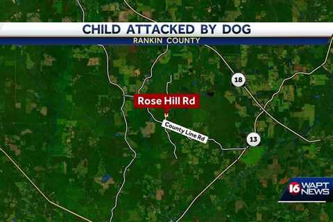 Child attacked by dog in Rankin County