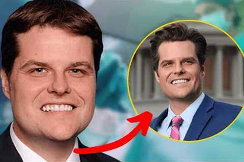 Matt Gaetz's Transformation is Turning Heads