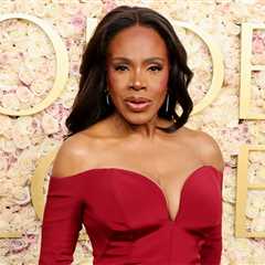 Scary Car Crash Injures Sheryl Lee Ralph’s Arm