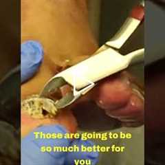 Trimming Time: A Talk on Nail Health 💅✨