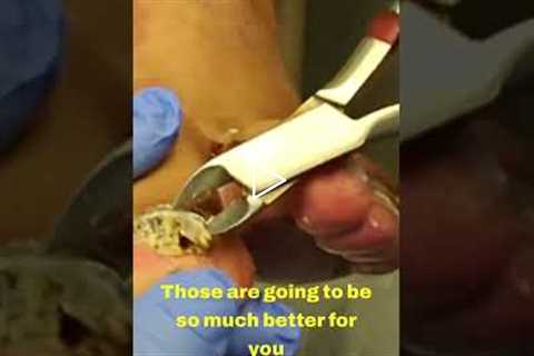 Trimming Time: A Talk on Nail Health 💅✨
