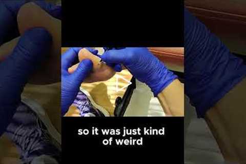The Mystery of the Farmer Who Didn't Want His Cows Photographed!  #drnailnipper #foothealth