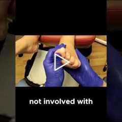 How Cutting Your Shoe Fabric Can Relieve Toe