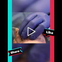 Diabetes and Nail Care Importance