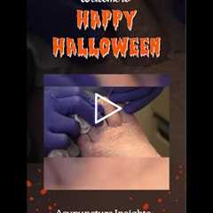 Acupuncture Insights