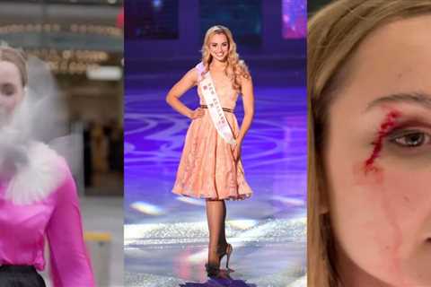 CRAZY VIDEO: Beauty Queen Reporter Hit in the Face and Left Bloodied by a Kamikaze Seagull During..