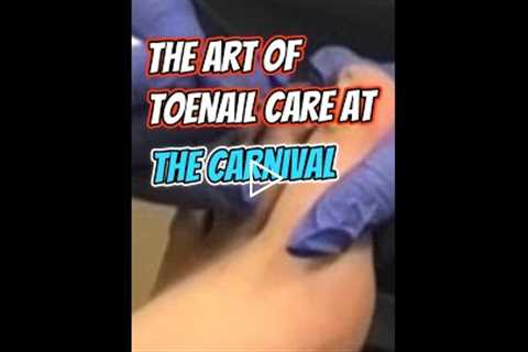 The Art of ToeNail Care at the Carnival 🎡💅