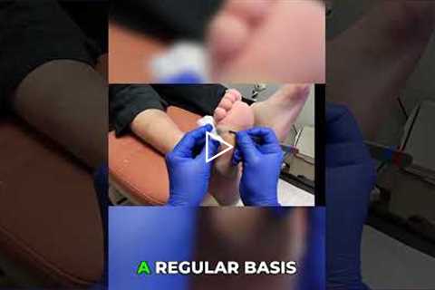 Open Wound & Callus - Do I Need a Doctor? 👣 | Foot Health, Infection Risk, Podiatry