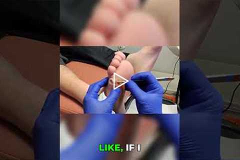 Big Foot Wound: Pressure and Rubbing Solutions 👣