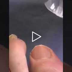 The Risks of Thick and Long ToeNails