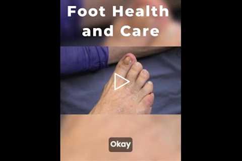 Managing Foot Health the Right Way | Comfort Comes First