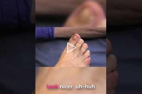 Pedicures & Problem Nails: What’s Safe? | Podiatrist Advice