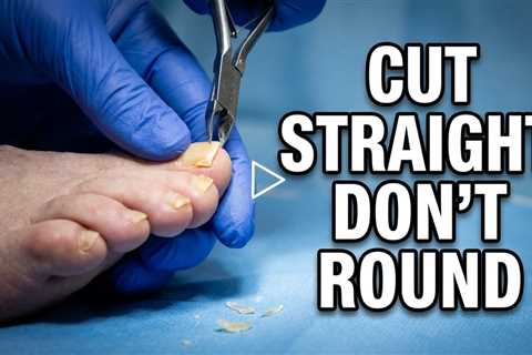 Why You Should Cut Toenails Straight Across 👣 a shorter version