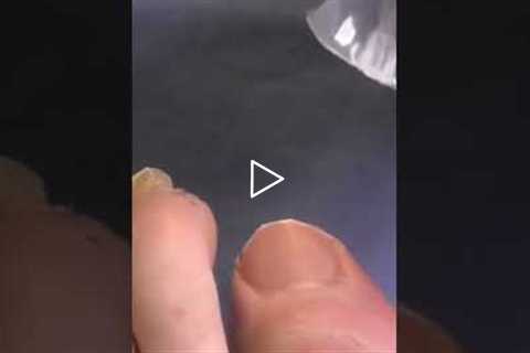 The Risks of Thick and Long ToeNails