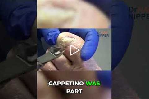 Hurricane Charlie vs. Cappetino Island Changes