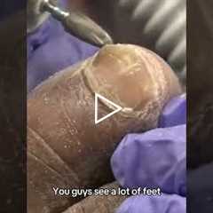 Dr. Nail Nipper Reveals What Most People Get Wrong About Foot Care #PodiatryCare