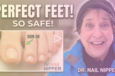 She Grew Her Toenails for 8 Months… Just for This Trim! 😲✂️