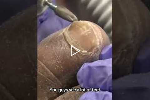 Dr. Nail Nipper Reveals What Most People Get Wrong About Foot Care #PodiatryCare