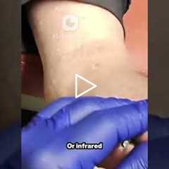 Neuropathy Clinics: Real Relief or Just a Scam? 🤔