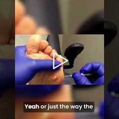 🎥 Removing Keratotic Horn | A Step-by-Step Procedure