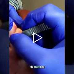 Identifying and addressing bleeding in callus tissue