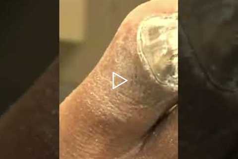 How to Properly Shape Your Toenails