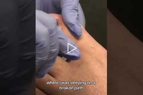 This Is What a 'Blizzard' Looks Like Up Close