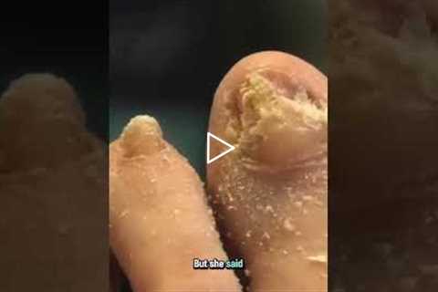 From Pre-Diabetic to Improving Fast: A1C Drops to 6.0!