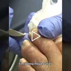 Honest Conversation During Foot Care Visit