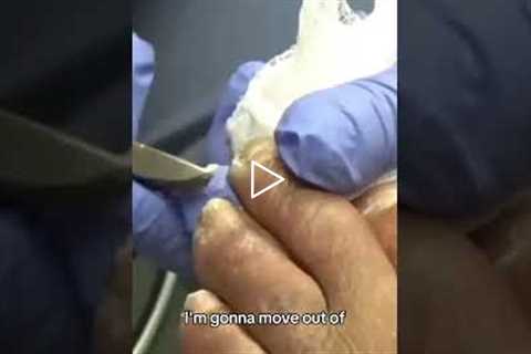 Honest Conversation During Foot Care Visit