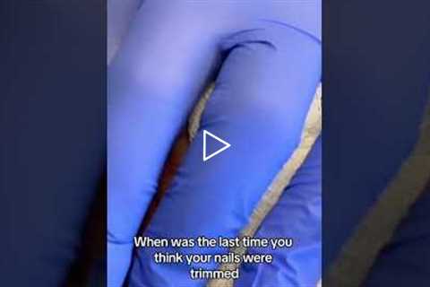 💔 My Wife Used to Trim My Nails... | A Story That Hits Hard