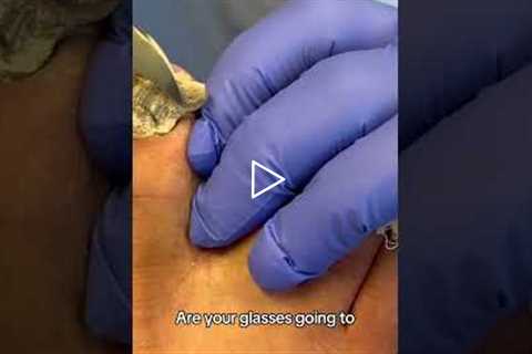 That Came Off in ONE Piece 😳🦶  #footcare #foothealth #drnailnipper
