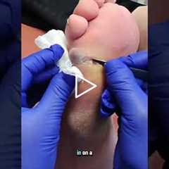 The importance of regular wound care