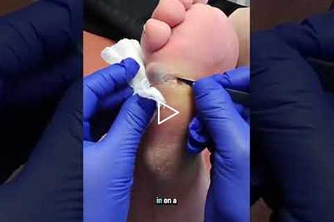 The importance of regular wound care