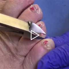 Daughter Brings Mom In After 2 YEARS... Nail Transformation 🦶