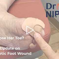 FEET-ure Friday | Did She Lose Her Toe? The Final Update on This Diabetic Foot Wound