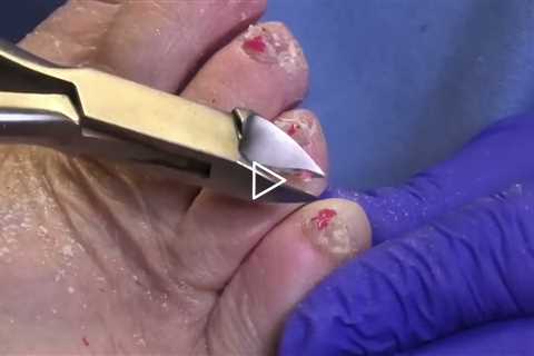 Daughter Brings Mom In After 2 YEARS... Nail Transformation 🦶